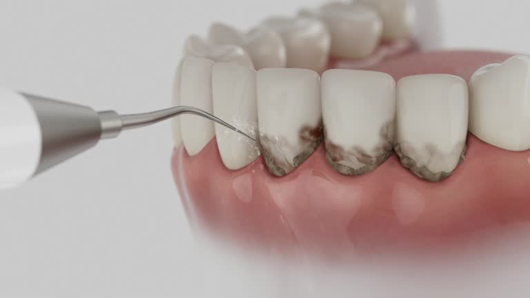 Reliable Dental Implants contractor in Ansonia, CT by Smile Center Dentistry